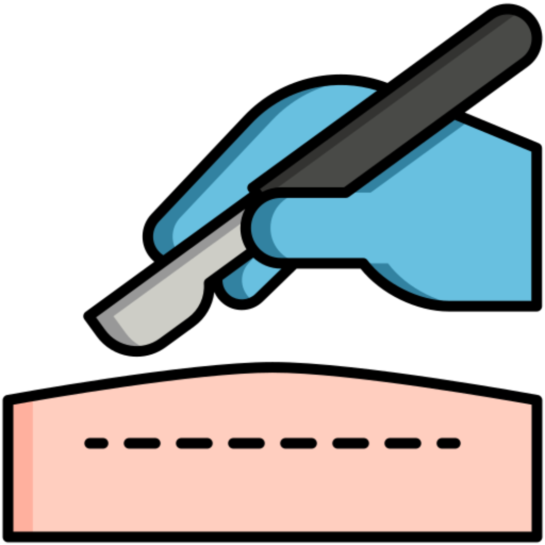 Cesarskie cięcie krok po kroku